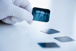 Имплантация зубов - уход после операции